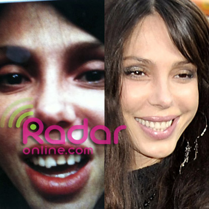 Before And After Celebrity Teeth. celebrities